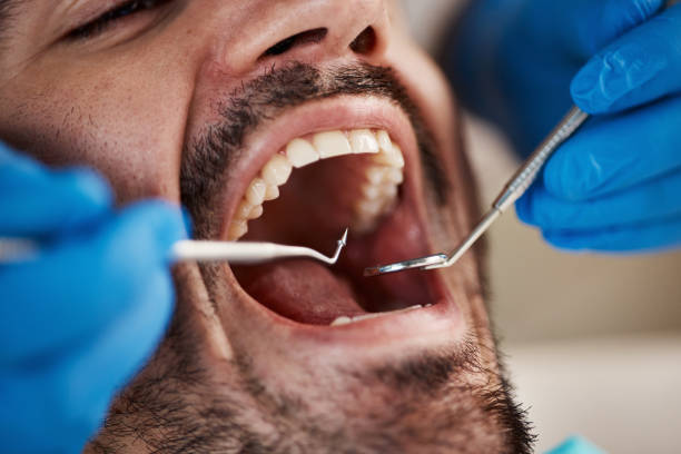 Best Dentist for Tooth Abscess  in Ledbetter, KY